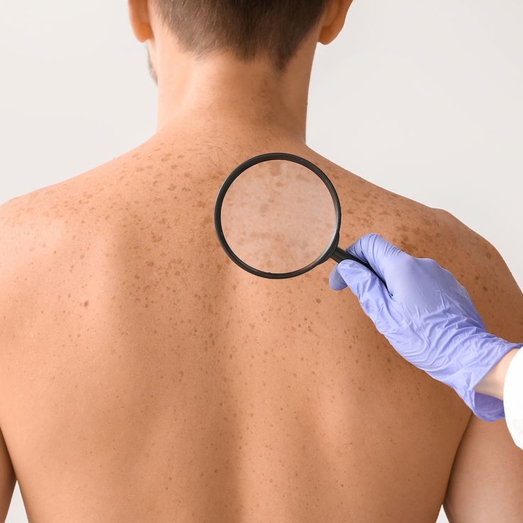 General & Surgical Dermatology