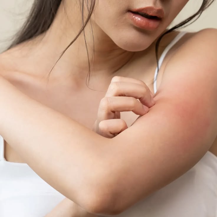 Infections & Allergies
